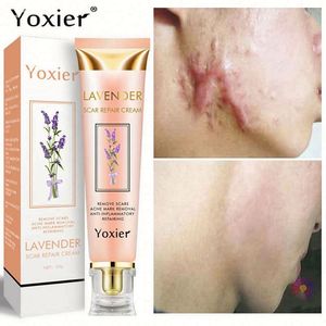 Crème réparatrice pour le <span class=keywords><strong>visage</strong></span> Yoxier pour femmes enceintes, soin de la peau, réparation des cicatrices d'acné, vergetures, correcteur de pigmentation, anti-allergique, apaisante - Product Image 4