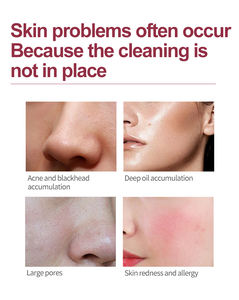 Prix d'usine, vente en gros, promotion spéciale pour le nouveau festival du commerce : équipement de massage à compresse chaude pour ouvrir les pores et nettoyer. - Product Image 6