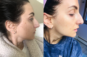 Oem Sắc Tố Tàn Nhang Sáng Whiting Chống Lão Hóa Mặt Huyết Thanh Chăm Sóc Da Làm Trắng Dark Spot Loại Bỏ Corrector Huyết Thanh Mặt - Product Image 5