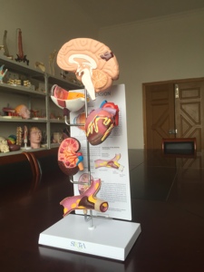 Modelo Anatómico de Cerebro Humano en Escala 1:1 de PVC con Modelo de Anatomía Patológica Hipertensiva - Product Image 5