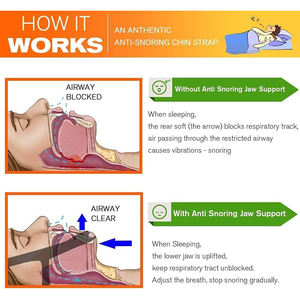 Sangles de mâchoire correcteur <span class=keywords><strong>respiratoire</strong></span> anti-ronflement personnalisable mentonnière <span class=keywords><strong>pour</strong></span> <span class=keywords><strong>dormir</strong></span> - Product Image 2