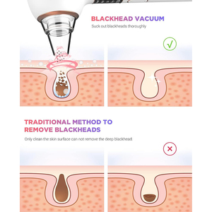 Hot bán điện comedone mụn <span class=keywords><strong>extractor</strong></span> với <span class=keywords><strong>3</strong></span> hút điện 5 đầu dò nén nóng Chức năng chân không mụn đầu đen Remover - Product Image 5