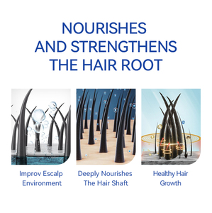 MOCHEQI <span class=keywords><strong>Shampoo</strong></span> Anticaduta Biologico di Alta Qualità a Prezzo di Fabbrica, Nutriente e <span class=keywords><strong>Antiforfora</strong></span> per <span class=keywords><strong>Capelli</strong></span> Ricci e <span class=keywords><strong>Grassi</strong></span> - Product Image 4