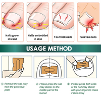 Patch de Correction des Ongles Incarnés Confortable, Prêt à l'emploi, Facile à Utiliser pour les Débutants - Meilleures Ventes