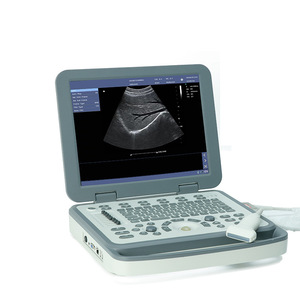 Kinh tế thú y thiết bị chẩn đoán màu đặc biệt máy tính xách tay B máy siêu âm cho động vật bệnh viện - Product Image 5