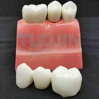 Modèle d'implant dentaire, couronne, pont, modèle amovible, modèle de dents en porcelaine, modèle de démonstration dentaire pour l'enseignement des dentistes