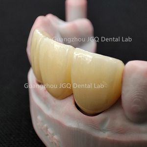 Couronnes en zircone solide avec <span class=keywords><strong>porcelaine</strong></span> Built-up Full Service China Dental Lab <span class=keywords><strong>Prix</strong></span> - Product Image 4