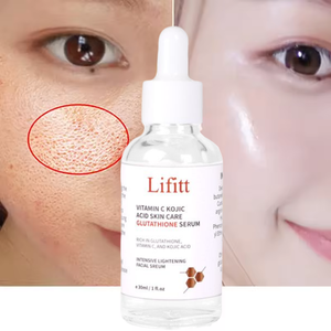 Veganer organischer Kollagen-Retinol-Serum-Hyper pigmentierung entferner mit klinischer Stärke für Anti-Aging-OEM/ODM auf Gesichts basis - Product Image 6