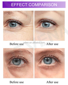 OTVENA Eye Repair Cream Under Eye Cream per occhiaie e gonfiori adatto per pelli Delicate <span class=keywords><strong>sotto</strong></span> l'area degli <span class=keywords><strong>occhi</strong></span> 0.28 once OEM - Product Image 4