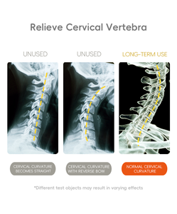 כרית ארגונומית מתכווננת מדגם YUE RISE בצורת חתול שמן מצויר וחמוד, עשויה מספוג זיכרון, לשינה ולקריאה - Product Image 4