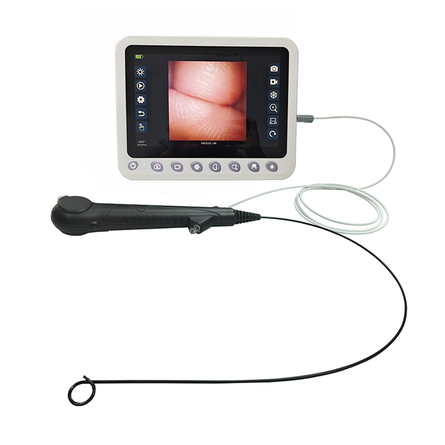 New Arrival Medical Flexible 7.5FR Single Use Ureteroscope Endoscope with CMOS Sensor 160K Resolution Durable Hot Selling