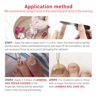 Soin des ongles, réparation des ongles, gommage antifongique pour les pieds, vernis à ongles pour les doigts et les orteils, soin des pieds
