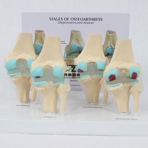 แบบจำลองข้อเข่า 4 ขั้นตอน พร้อมตัวหนีบด้านหลัง แบบจำลองข้อเข่าสำหรับการสอนศัลยกรรมกระดูก ขายตรงจากโรงงาน - Product Image 4