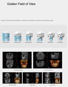 <strong>Dental</strong> Clinic Data Format DICOM 3.0 All-in-One Imaging 16x18 Inch 3D CBCT X-ray with CEPH Electricity Powered CE Certified - Product Image 4