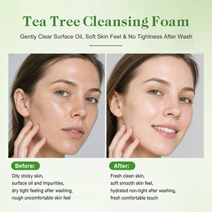 <span class=keywords><strong>Limpiador</strong></span> <span class=keywords><strong>Facial</strong></span> Suave con Extracto de Árbol de Té Orgánico, Glutatión, Hidratación Profunda, Blanqueador e Iluminador - Product Image 2