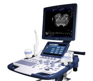 Échographe Doppler Couleur d'<span class=keywords><strong>Occasion</strong></span> LOGIQ F6 pour Examen d'Imagerie Hospitalière Multi-Sections et Routine - Product Image 1