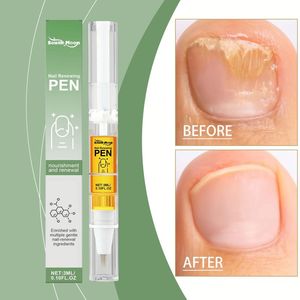 South Moon Wholesale Private Label <span class=keywords><strong>Meilleur</strong></span> <span class=keywords><strong>Traitement</strong></span> Antifongique pour les Ongles, Solution Restauratrice pour les Mycoses des Ongles des Pieds et des Mains, Stylo Antifongique South - Product Image 3