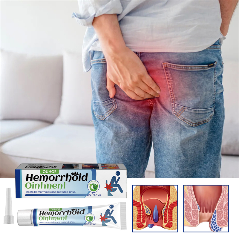 OUHOE 20g Hemorrhoid Ointment Pain Itch Bleed Swelling Relieving Hemorrhoids Cream