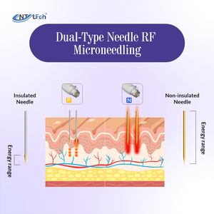 Appareil de Microneedling RF Vertical <span class=keywords><strong>à</strong></span> <span class=keywords><strong>Aiguilles</strong></span> Isolées pour Lifting Facial, <span class=keywords><strong>Radiofréquence</strong></span> <span class=keywords><strong>Fractionnée</strong></span> pour le Raffermissement de la Peau et l'Élimination des Rides - Product Image 5
