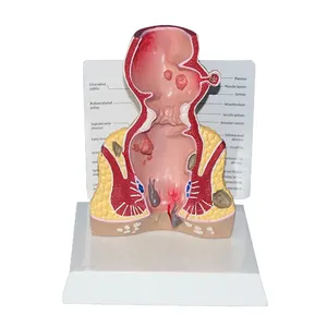 인간 PVC 해부학 직장 모델