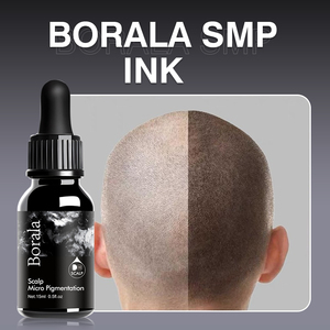 <span class=keywords><strong>Tinta</strong></span> Profesional <span class=keywords><strong>de</strong></span> Micropigmentación Capilar con Carbón Negro SMP <span class=keywords><strong>para</strong></span> Tratamiento <span class=keywords><strong>de</strong></span> Crecimiento del Cabello - Marca Privada Corea - Product Image 1