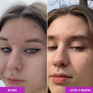 Suero Facial Delicado con 10% de Niacinamida (Vitamina B3), Calma el Enrojecimiento, Repara la Barrera Cutánea, Retiene la Humedad, Cuidado Nocturno para Piel Sensible, 30ml - Product Image 6