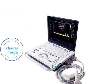 Multifunctionele Draagbare Veterinaire Menselijke Echografie Machine Kleur Doppler <span class=keywords><strong>Usg</strong></span> Sonografie Scanner Cu09 - Product Image 4