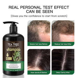Set di <span class=keywords><strong>Shampoo</strong></span> e Balsamo Naturale Personalizzato con Etichetta Privata, Olio di Tea Tree Organico <span class=keywords><strong>per</strong></span> <span class=keywords><strong>Crescita</strong></span> Rapida <span class=keywords><strong>dei</strong></span> <span class=keywords><strong>Capelli</strong></span> e Controllo della Forfora - Product Image 6