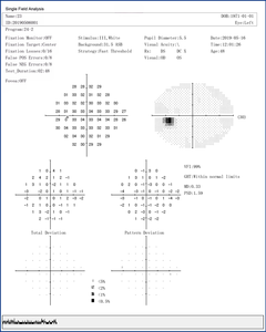 BIO-1000 WELLSIGHT CE ISO Perímetro Oftálmico Automatizado para Pruebas de <span class=keywords><strong>Campo</strong></span> <span class=keywords><strong>Visual</strong></span>, 1 Año de Garantía, 25 KG - Product Image 5