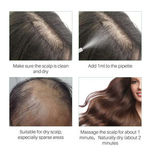 Natural Nourish Follicle Anti-<b>Hair</b> Loss Silicone-Free <b>Hair</b> <b>Growth</b> <b>Spray</b> 30ml Suitable for Thinning <b>Hair</b> - Product Image 5