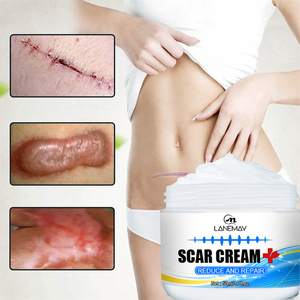 Best Sell Gel per la rimozione delle cicatrici trattamento per l'acne cicatrici sbiancanti crema Gel per la cura crema per il viso a base di erbe per adulti e lozione crema per la vitiligine - Product Image 1