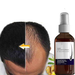 Tự nhiên tăng trưởng tóc huyết thanh cho phụ nữ rụng tóc mọc lại - Product Image 1