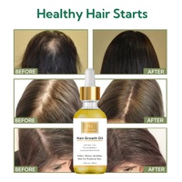 Private Label 30ml Rosmarin Schnelles Haarwuchsöl Natürliches Minz-Kopfhaut- und Haarstärkungsöl