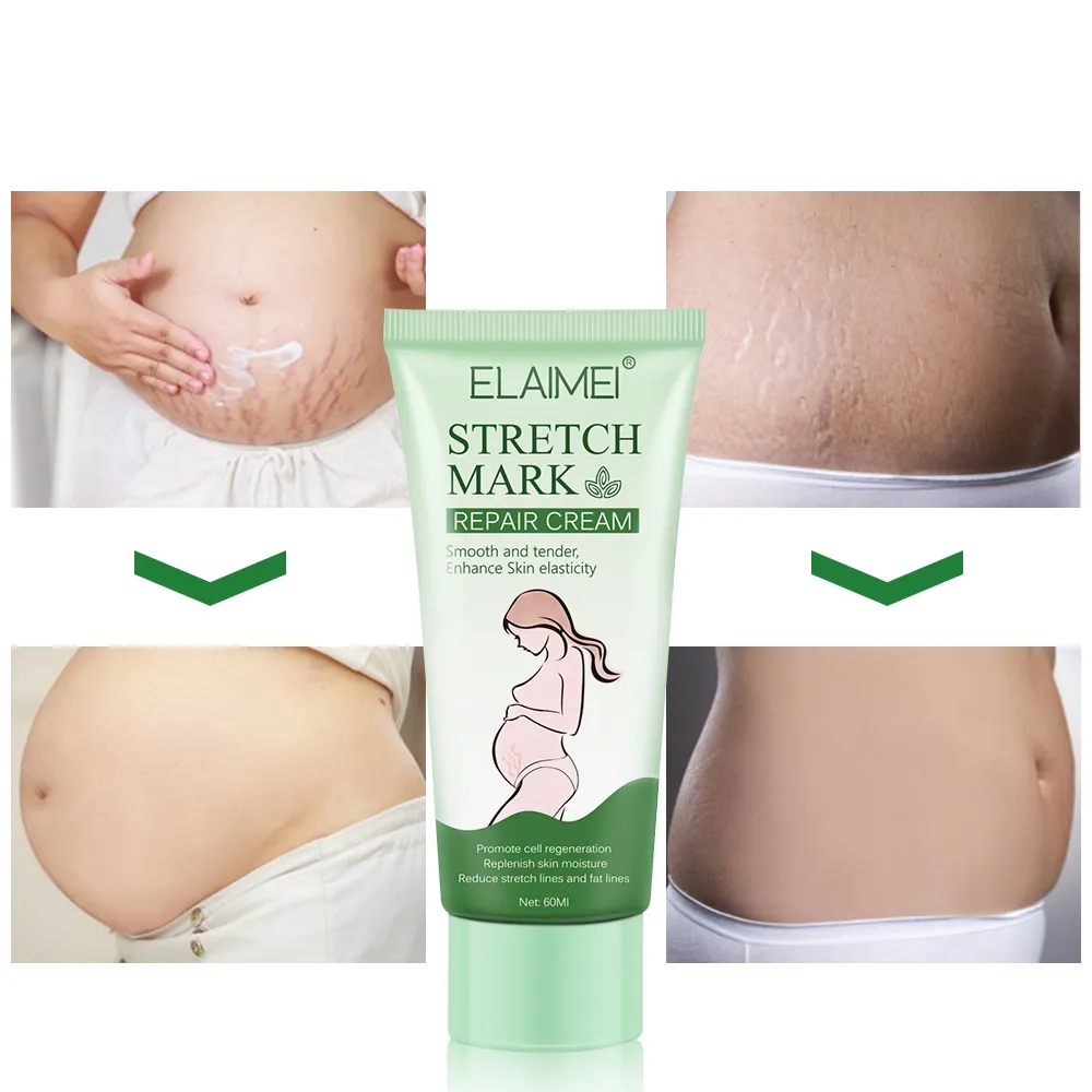 كريم إزالة علامات تمدد الجسم بفعالية علامة خاصة لوشن 7 أيام من الحمل كريم علامات تمدد الجلد لإصلاح البشرة الفاتحة