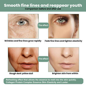 Nuevo coreano antienvejecimiento ácido hialurónico niacinamida cuidado de la piel suero facial blanqueamiento Facial antienvejecimiento suero diario 30ml - Product Image 4