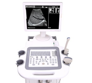 Sonde d'<span class=keywords><strong>échographie</strong></span> numérique intégrale de pointe pour scanner vétérinaire sur chariot – Dispositif de surveillance avancé - Product Image 3