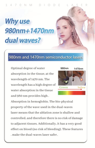 เครื่องตัดเลเซอร์รุ่นใหม่ล่าสุด วัสดุ ABS ประสิทธิภาพสูง พร้อมความยาวคลื่นที่แตกต่างกันสามระดับ - Product Image 3