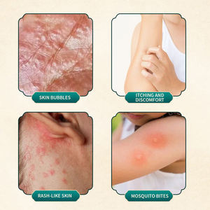 <span class=keywords><strong>Crema</strong></span> Antiprurito alle Erbe di Hong Kong per Psoriasi, Tinea, Rossore della Pelle, Unguento a Base di Glicerina per Uso Corporeo - Product Image 4