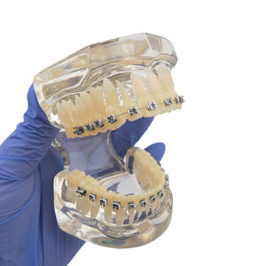 Dental Orthodontic Model Resin Typodont with Metal Bracket <b>Teeth</b> Study Teaching Demonstrator Manual Use Smiledental TM-B7-01 - Product Image 3