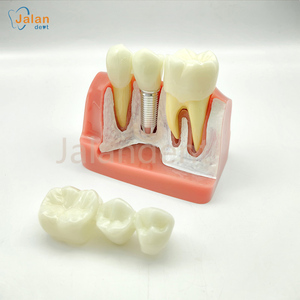 Dentaire Bon Prix Dentaire Enseigner Dent Modèle Caries Dentaires Développement Modèle - Product Image 4