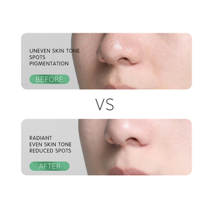 Vitamin C Aloe Vera Sữa Rửa Mặt Làm Sạch Sâu Và Giữ Ẩm Da Mềm Mại Bàn Chải Đầu Mặt Sữa Rửa Mặt Với Glycerin Bọt Gel - Product Image 4