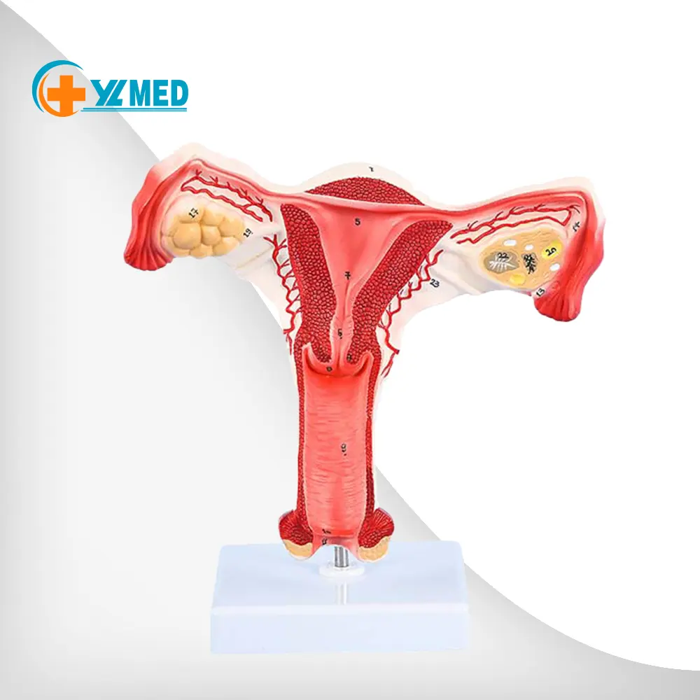 Medical Science Magnified Human Anatomical Model Normal Educational Models Human Anatomy Uterus Model