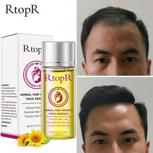 RtopR เอสเซนส์สมุนไพรบำรุงเส้น<span class=keywords><strong>ผม</strong></span> 20 <span class=keywords><strong>ม</strong></span>ล. สำหรับ<span class=keywords><strong>ผม</strong></span>แห้งเสีย ช่วยฟื้นฟู บำ<span class=keywords><strong>รุ</strong></span><span class=keywords><strong>ง</strong></span>ให้นุ่มสลวย เงางาม ลดการหลุดร่ว<span class=keywords><strong>ง</strong></span> บำ<span class=keywords><strong>รุ</strong></span><span class=keywords><strong>ง</strong></span>ผ<span class=keywords><strong>ม</strong></span><span class=keywords><strong>ยาว</strong></span> - Product Image 2