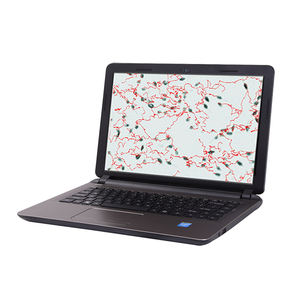 محلل الحيوانات المنوية محلل جودة الحيوانات المنوية - Product Image 3