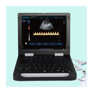 Ultrassom <span class=keywords><strong>Doppler</strong></span> Colorido Portátil 3D com Tela HD de 15 Polegadas e Sonda Convexa para Uso Humano, Veterinário, Obstétrico, Ginecológico e Cardíaco - Product Image 1