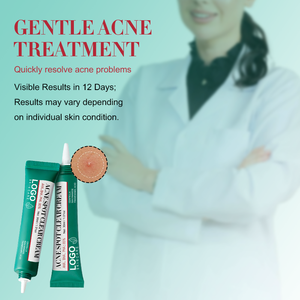 Crème anti-acné OEM de haute qualité : Réduit les éruptions cutanées, soulage les rougeurs, retient l'hydratation, action rapide, éclaircit les taches brunes - Product Image 6