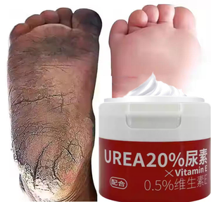 Crema per la Cura dei Piedi con 0,5% di Vitamina E e 20% di Urea, Idratante, Sbiancante, Rimuove la Pelle Morta, Ripara le Funzioni Fungine, Previene Secchezza e Screpolature - Product Image 1