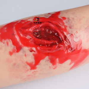 แบบจำลองการบาดเจ็บแบบสวมใส่ได้โมดูลผิวหนังการจำลองการบาดเจ็บบาดแผลบาดแผลมีเลือดออก - Product Image 2