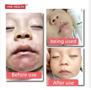Krim Eksim Bayi MeiZheng 15g, Disetujui Dokter Anak, Herbal Antibakteri, Pereda Gatal Kulit untuk Ruam Panas, Ruam Popok, Plester Cina - Product Image 6