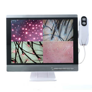 ماسح فروة الرأس اللاسلكي كاميرا HD الشعر بصيلات الشعر لالتقاط الصور وتحليل الفيديو - Product Image 6